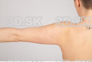 Arm texture of Casey 0002